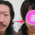 日本單眼皮大叔去割雙眼皮，就是為了徹底擺脫「猥褻臉」！沒想到「超詭異的結果」笑翻所有網友了