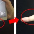 一名日本用戶發現自己長時期使用手機，除了對眼睛及頸椎傷害後，還發現另一個問題出現了。