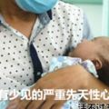 男嬰心髒畸形可能活不過3個月，手術後靠「人工心肺」起死回生！