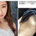 21歲嫩媽生4胞胎「肚皮全是妊娠紋」被酸很噁心　她PO照怒轟：請尊重全世界的女性！