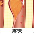 連續8年「拿下第一名的減肥菜單」　醫師也推崇：有效鏟肉、抗高血壓