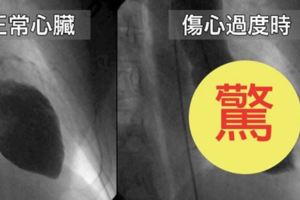 失去摯愛真的會「心碎」！科學家證實「和心臟病一樣嚴重」，破碎的心無法痊癒還會死！