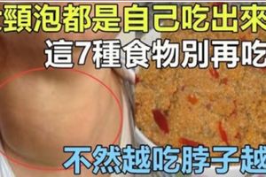 「大頸泡」都是自己吃出來的，這7種食物別再吃了，越吃脖子越腫！