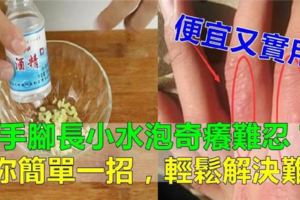 手腳長小水泡奇癢難忍？教你簡單一招，輕鬆解決難題，省錢又省心！（很實用）