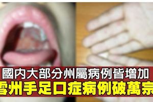 國內手足口症病例逾3.7萬宗　雪州最嚴重