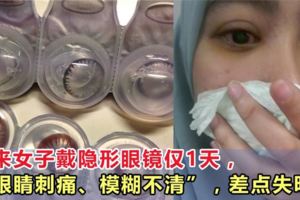 馬來女子戴隱形眼鏡僅1天，「眼睛刺痛、模糊不清」，差點失明！