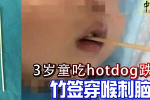 千萬不可以讓孩子在跑跳時吃東西！3歲童吃hotdog跌倒-竹簽穿喉刺腦干!