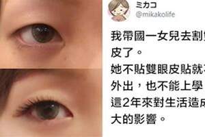 媽帶「國一女兒去整形」被罵爆！　她透露「已痛恨至快精神病」網看完深思