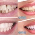 無論男女，一口黃牙有救了！2分鐘就把多年累積的黃牙垢都去除了！牙齒變得又白又乾淨！