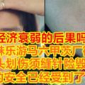 【經濟衰弱的後果嗎？】大馬正妹樂游馬六甲茨廠街遭攫奪額頭劃傷須縫針險毀容！人民的安全已經受到了威脅！