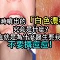 你擠過痘痘嗎？「滋」出來的那一坨白色的是什麼？！