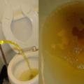 清晨的「第一泡尿」最直接看出你的健康狀態！尿上「浮泡泡」男人絕對要警戒，而黃的像茶就更可怕了...
