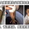 4歲女童疑遭生父與繼母虐待，遭囚廁所、香煙燙背、雙眼瘀腫到睜不開