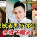 女兒被渣男打到進ICU的樣子曝光！怪不得他的岳父一直說不會放過他！原來被打倒那麼傷！