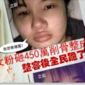 我想變楊冪！女粉砸450萬削骨整成楊冪！整容後全民跪了W0W～