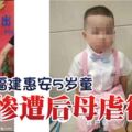 福建惠安5歲童慘遭後母虐待死