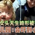 2歲女頭天生畸形被拒入學幼兒園：會嚇到小朋友