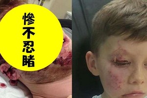 眼看這輛失控的車子就要撞上侄子了！叔叔做得事情讓人''想一百遍''都想不到他會這樣做...