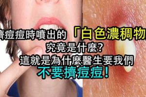 你擠過痘痘嗎？「滋」出來的那一坨白色的是什麼？！