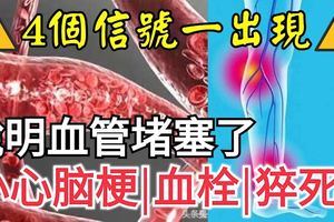 4個信號一出現，說明血管「堵塞」了，小心腦梗、血栓、猝死！