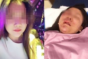 「交往7年」談分手生恨她被女友打成豬頭