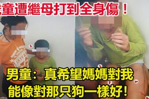 9歲童遭繼母打到全身傷！男童：真希望媽媽對我，能像對那隻狗一樣好！