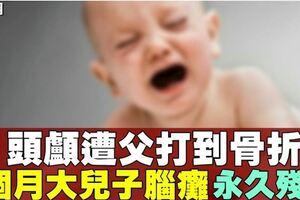 深夜被哭聲吵醒　父毆半歲兒頭部致腦癱