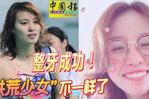 整牙成功！「洪荒少女」傅園慧不一樣了！