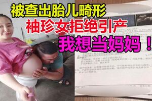 袖珍女懷孕後被查出胎兒畸形，拒絕醫生為她引產：我想當媽媽