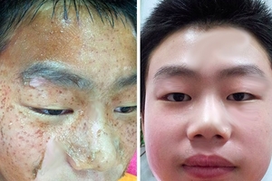 複活了！臉上斑一吃就立馬變白，三天內暗黃、雀斑、黑點全消失了！神到不敢相信！