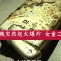 小米手機突然起火爆炸女童三度燒傷