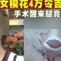 女模花4萬令吉隆鼻手術醒來腿竟殘廢了