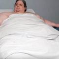445公斤的肥胖男子，被醫生警告再不減肥性命將會不保！