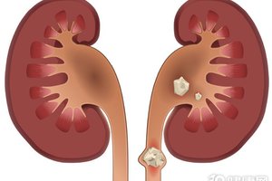 這4個「信號」，是在告訴你：人未老，腎先衰！