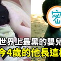 還記得這個「世界上最黑的嬰兒」嗎？他已經長大了！如今成為世界觀光景點…