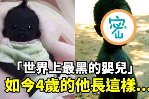 還記得這個「世界上最黑的嬰兒」嗎？他已經長大了！如今成為世界觀光景點…