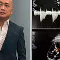 男星「心臟瓣膜少1片」仍服役2年！昔為挺兄弟遭關禁閉