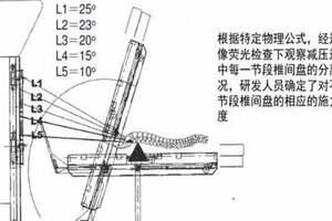 「瘸子」走路不拐了 秦皇島軍工醫院康復醫學中心個性化康複方案為患者解憂