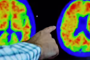 很容易做到！研究曝「3招」真能防癌、防失智　醫師也激推