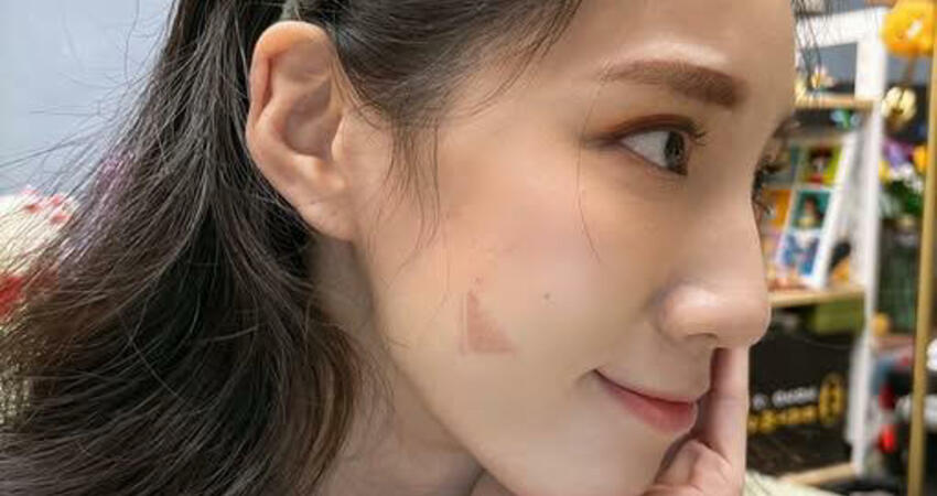 過年前破相出事了！女星高溫烙印「右臉慘燒焦」 驚悚傷疤照曝光
