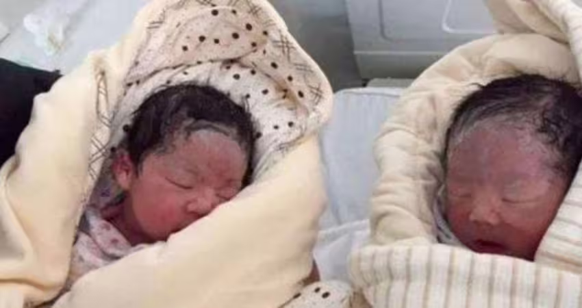 孕婦剖腹產完大喊「有東西在動」　醫護一看嚇傻