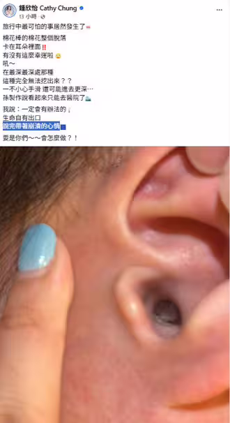 棉花棒卡進耳朵深處,鍾欣怡發文求解,網友熱心給建議。(圖/翻攝自鍾欣怡 Cathy Chung 臉書) 棉花棒卡進耳朵深處,鍾欣怡發文求解,網友熱心給建議。(圖/翻攝自鍾欣怡 Cathy Chung 臉書)