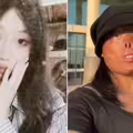 遭恐怖情人毀掉五官！23歲女子樂觀擁抱人生 「找到真愛」創業超成功