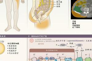 肥胖管理 | NEJM