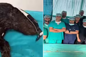 少女腹痛送醫!體內驚見「210公分毛球」被1習慣害慘 少女腹痛送醫!體內驚見「210公分毛球」被1習慣害慘