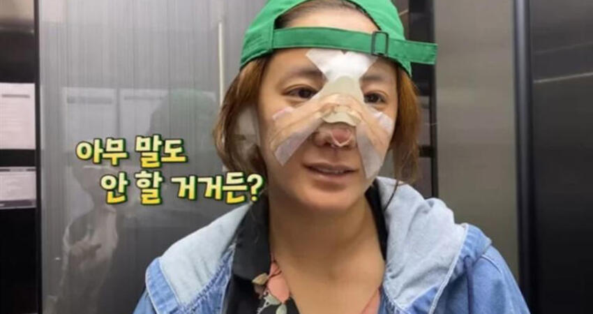 才砸80萬整鼻！女星「街頭重摔」慘毀容驚悚照曝光 網一看嚇傻