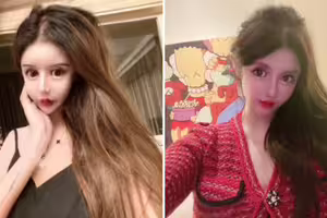 20歲女砸1700萬動刀上百次 「整型前清秀樣子曝光」她喊:還會繼續整 20歲女砸1700萬動刀上百次 「整型前清秀樣子曝光」她喊:還會繼續整