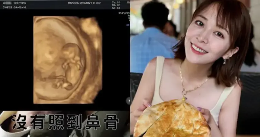 YouTuber徐海莉Hailey產檢，被告知未能看到寶寶的鼻骨，當場淚灑診間，感覺像被澆了一盆水，瞬間心中不安與焦慮