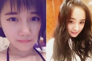 女大學生花百萬欲整容成楊冪結果卻變成這樣