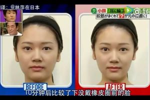 1根皮筋10分鐘臉竟小一圈 日本妹子為此瘋狂